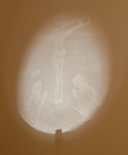 Misericordia